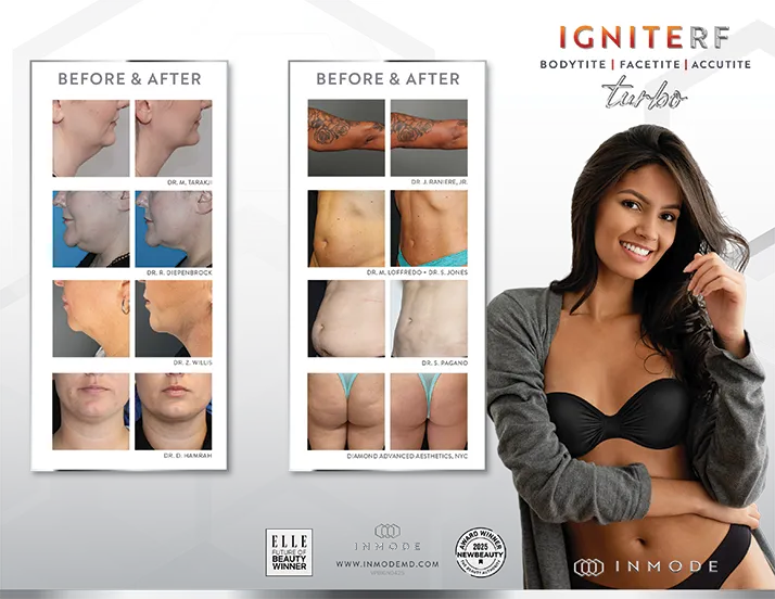 Primary Care Delray Beach FL Ignite RF InMode Primary Care Delray Beach FL Ignite RF InMode